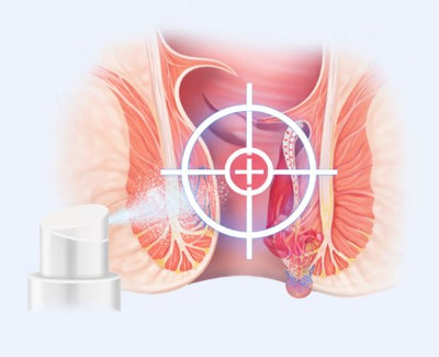 Targeted Relief Action