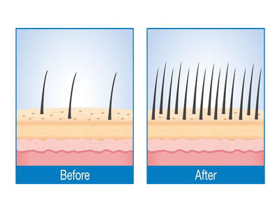 Scalp Repair & Growth Support