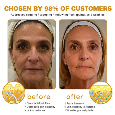 Miasaki Botox Bee Venom Lifting Cream