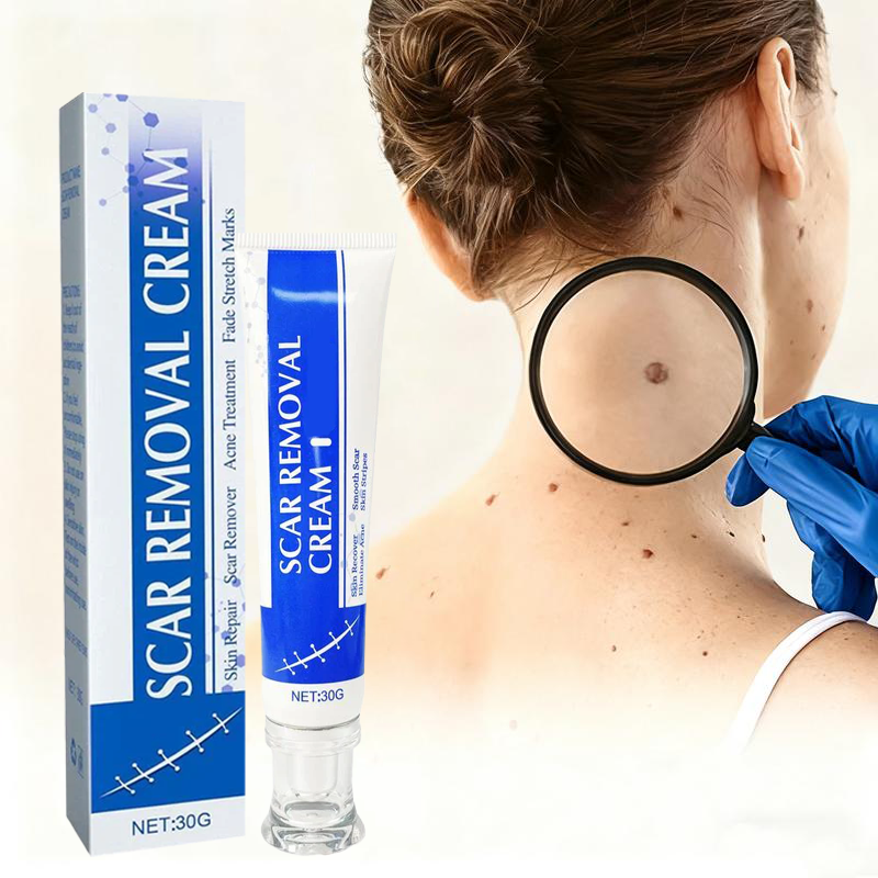 Miasaki Scar Removal Cream