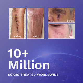 Miasaki Silicone Scar Gel