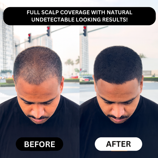 Miasaki Hair Density Filler