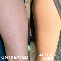 Miasaki Strawberry Skin Cream